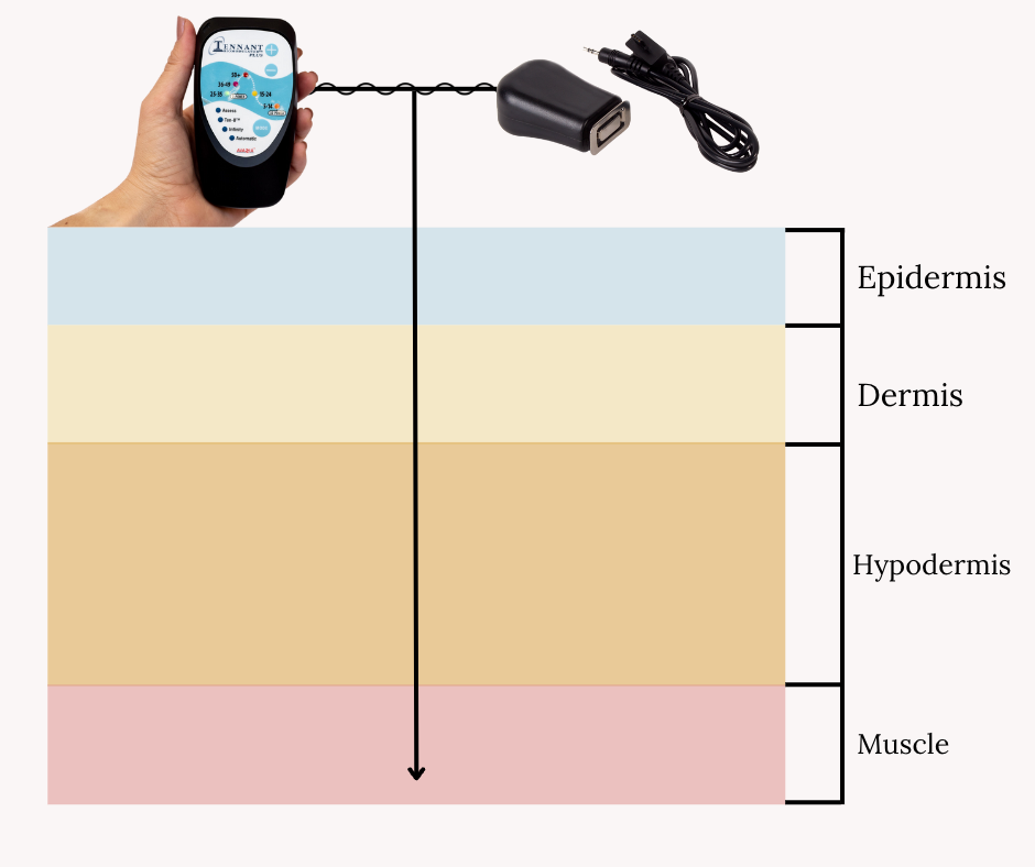 Microcurrent_Face_Electrode_Plus chart